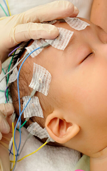 Bebek EEG Testi